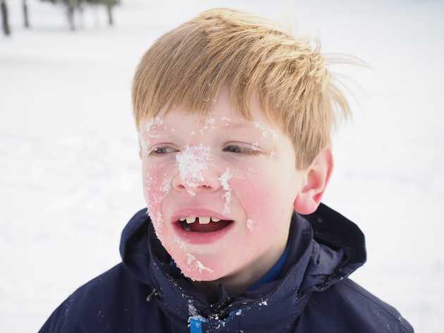 Snowy face